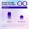 imageAnua UltraThin Spot Cover Patch Invisible Hydrocolloid Acne Patch for Face Cute Pimple Patches Centella Care for Sensitive Skin KPop Demon Hunters Case Korean Skincare 55ea