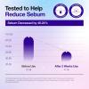 imageAnua UltraThin Spot Cover Patch Invisible Hydrocolloid Acne Patch for Face Cute Pimple Patches Centella Care for Sensitive Skin KPop Demon Hunters Case Korean Skincare 55ea