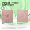 image:imageAnua Azelaic Total Soothing Trio Azelaic Acid amp Cica Lightweight amp Hydrating Korean Skincare Set