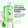image:imageAnua Azelaic Total Soothing Trio Azelaic Acid amp Cica Lightweight amp Hydrating Korean Skincare Set