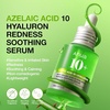 image:imageAnua Summer Duo Anua Azelaic Acid 10 Hyaluron Redness Soothing Serum amp ZeroCast Moisturizing Sunscreen SPF 50 Facial Serum amp Sunscreen for Face Korean Skincare